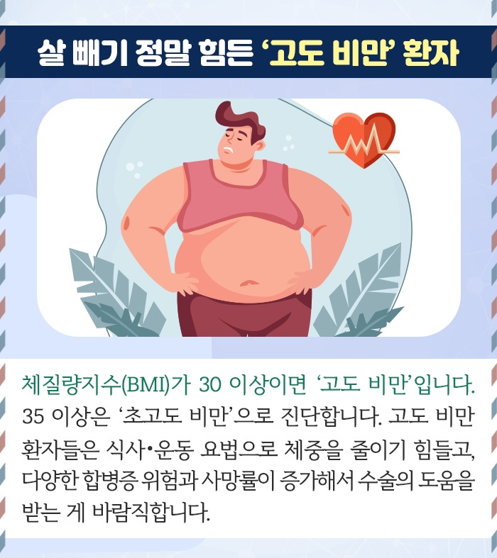위소매절제술_2.jpg