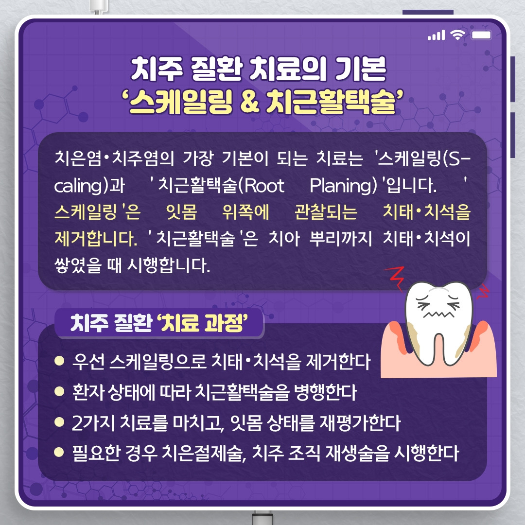 치주질환_05.jpg