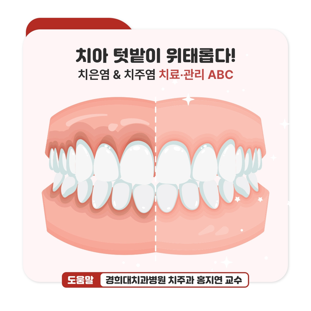 치은염&치주염_01.jpg