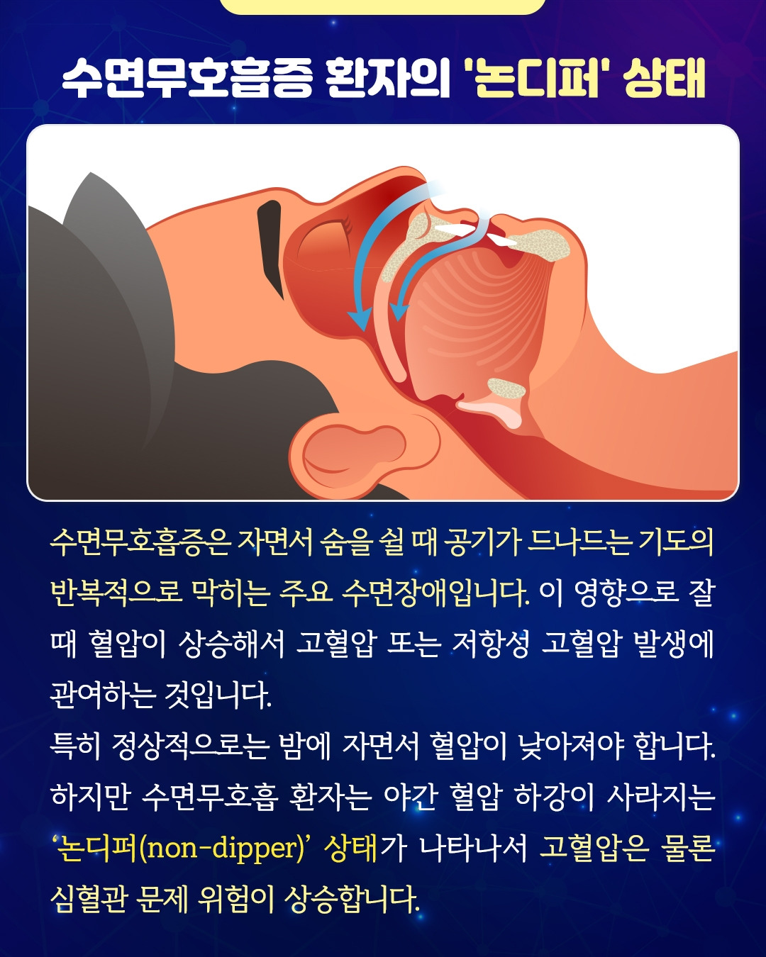 저항성 고혈압_06.jpg