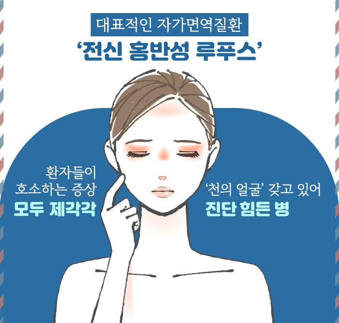 전신 홍반성 루푸스_2 .jpg
