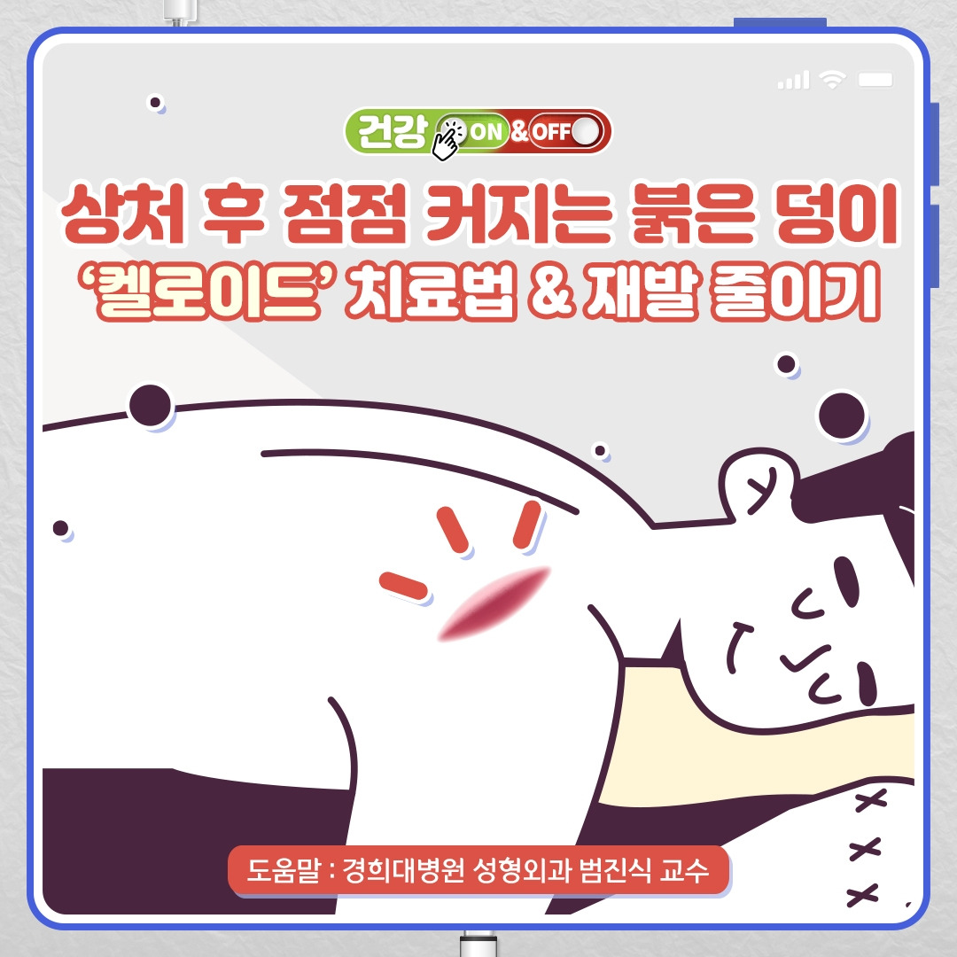 켈로이드_01 .jpg