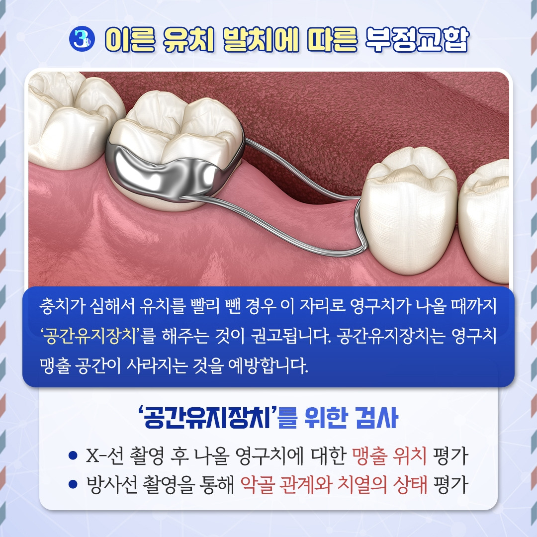 소아교정치료_06.jpg