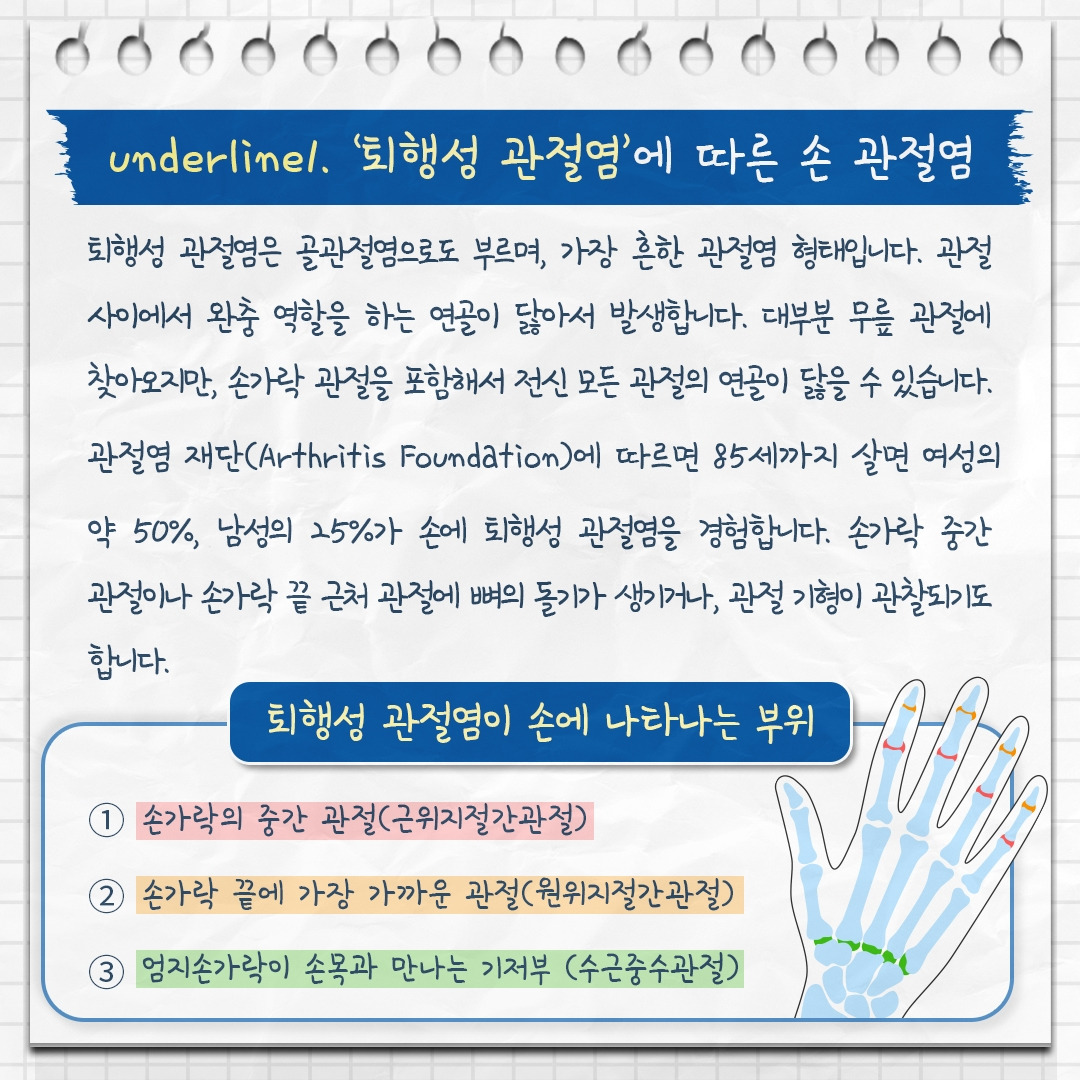 손 관절염_03.jpg