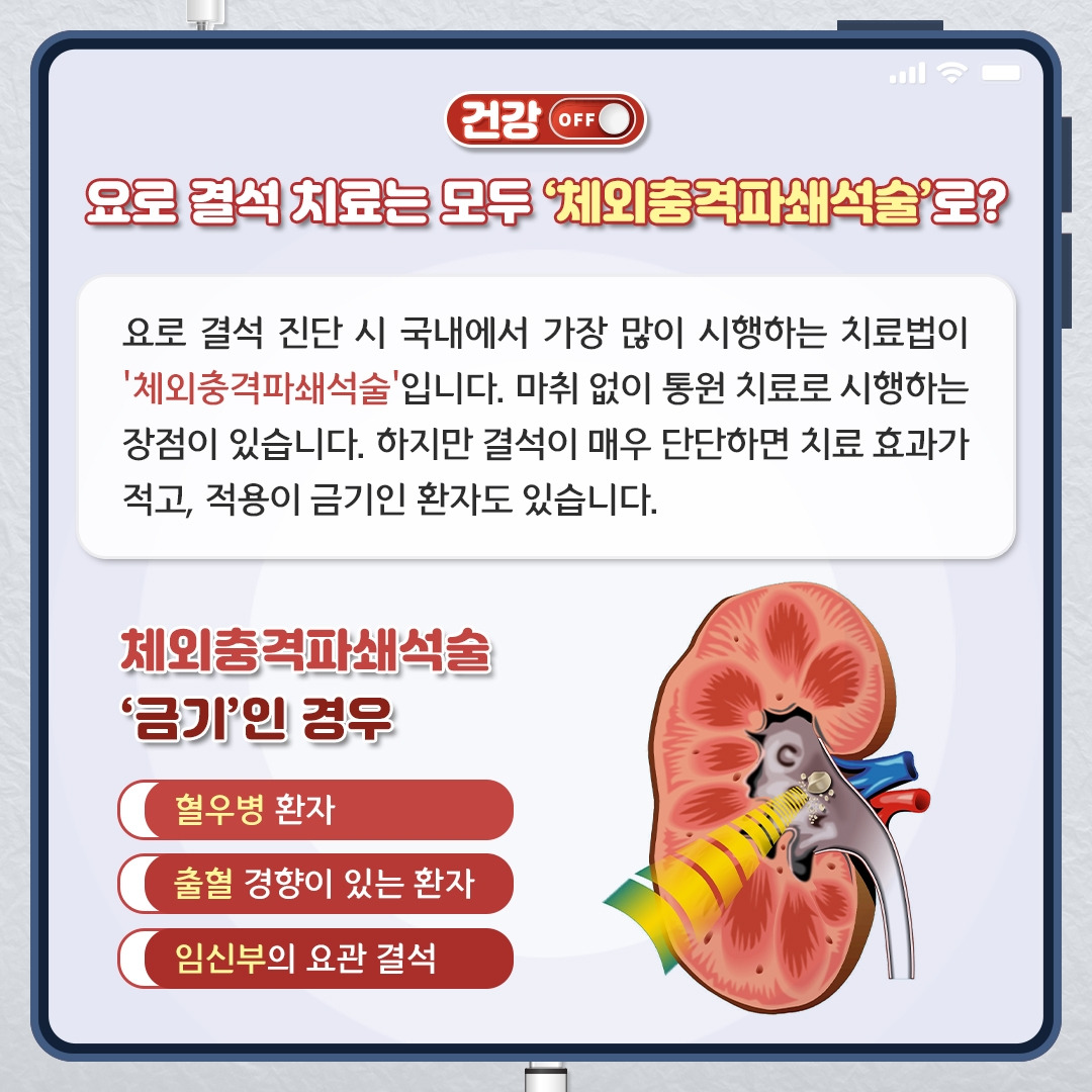 요로결석_04.jpg