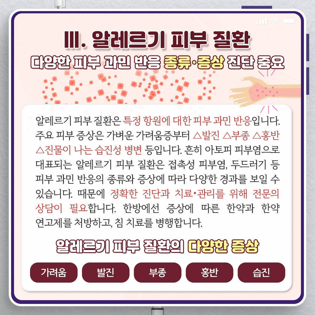 알레르기_06.jpg
