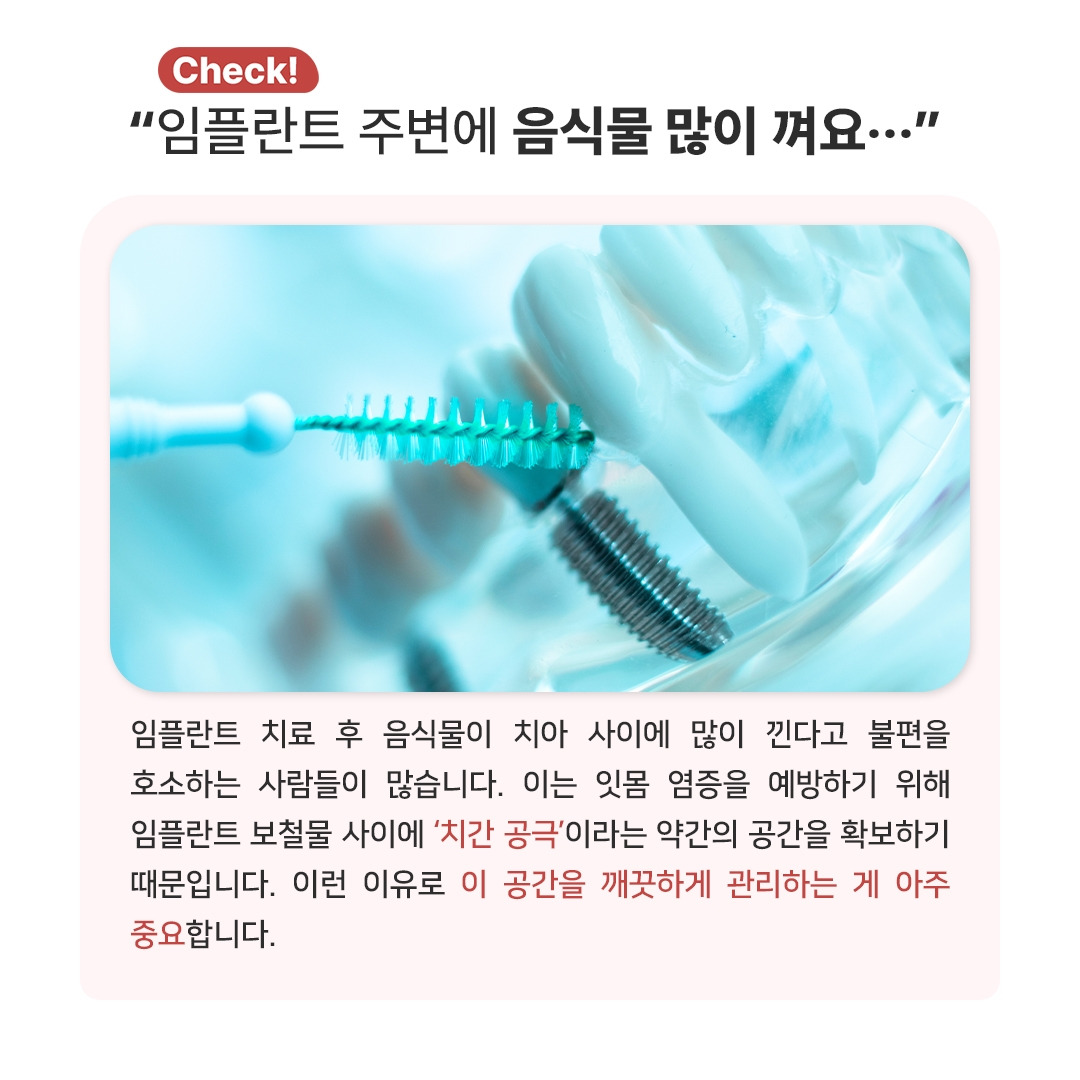 임플란트주위염_04.jpg