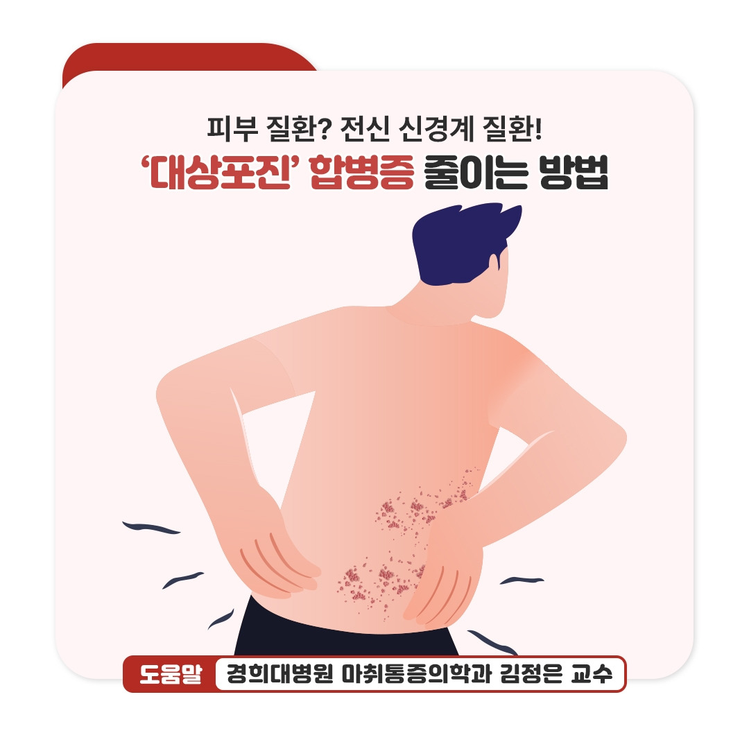 대상포진_01.jpg