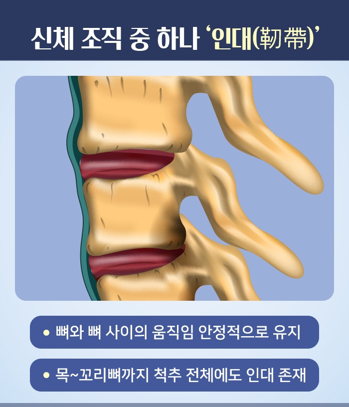 후종인대골화증_02.jpg