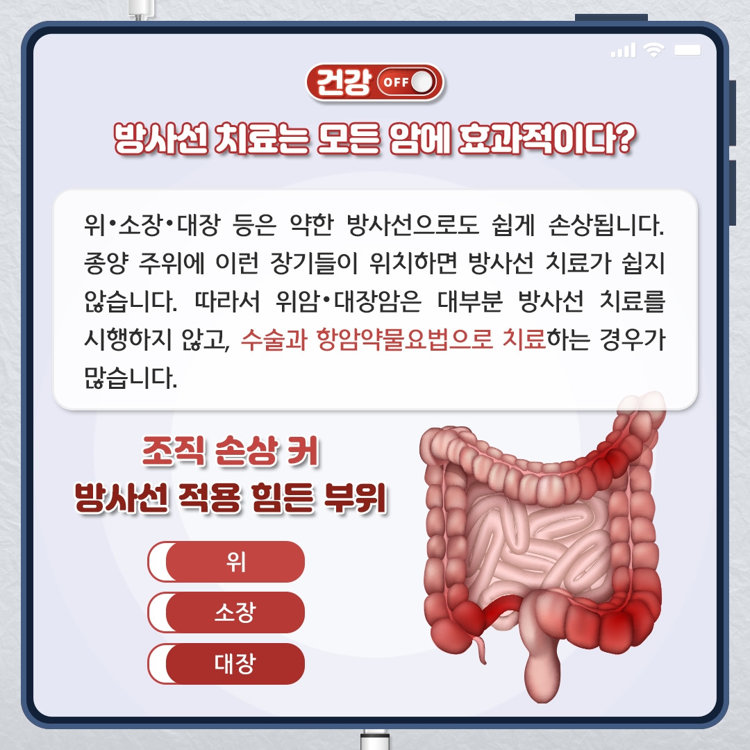 방사선 치료_05.jpg
