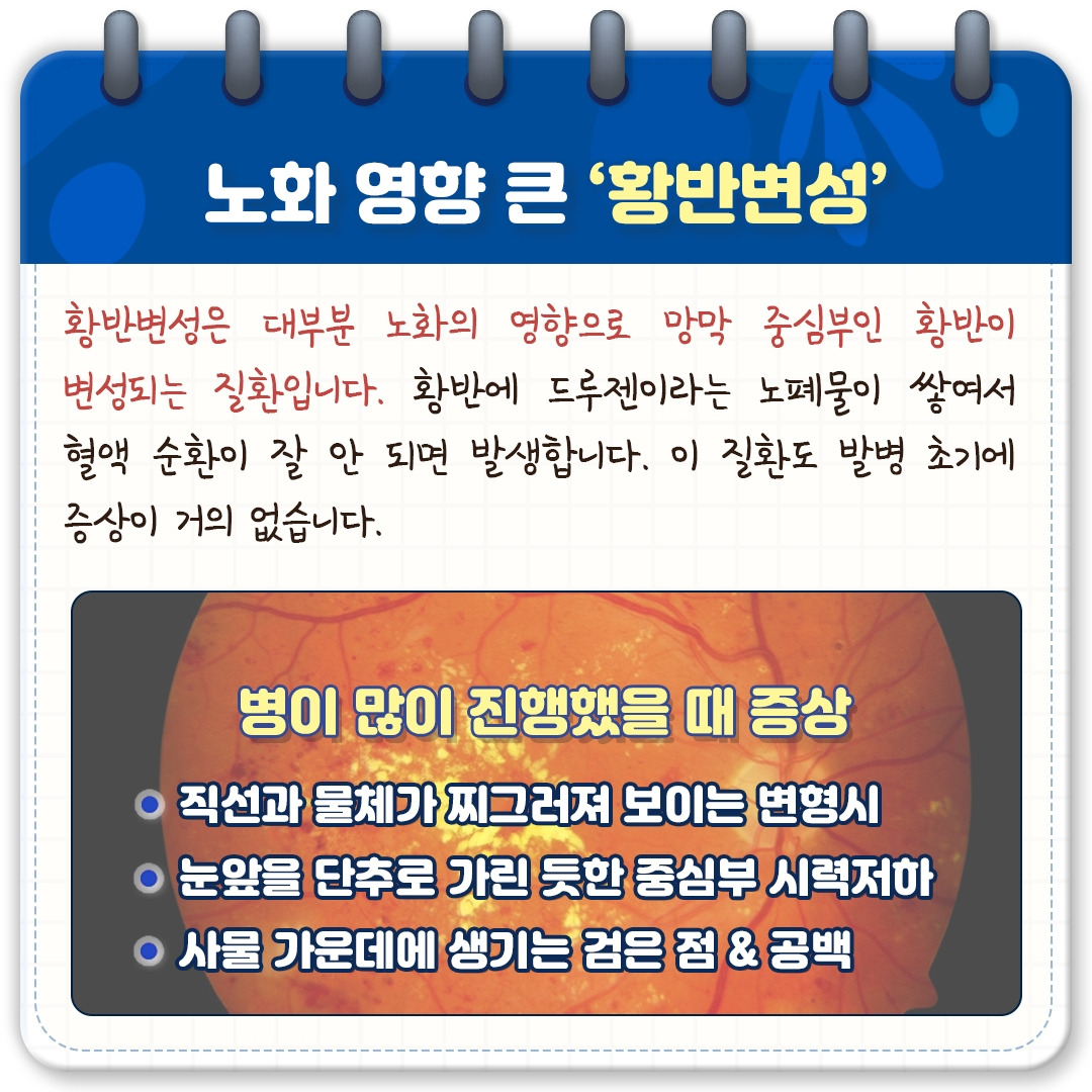 망막 질환_04.jpg