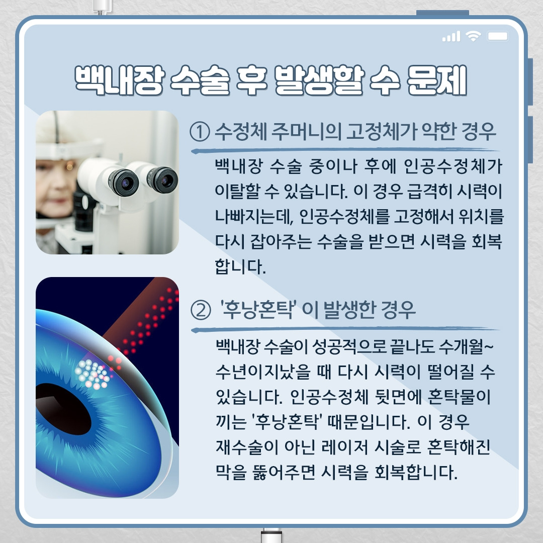 백내장_08.jpg