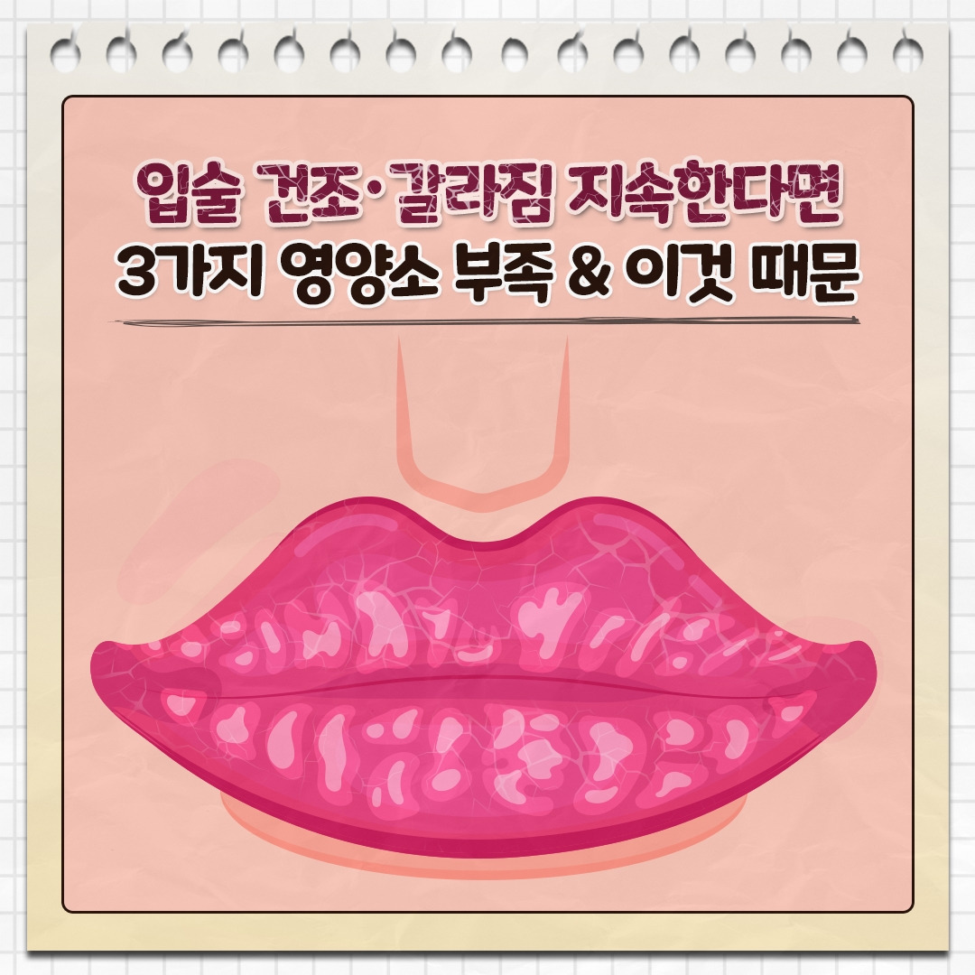 입술건조증_01.jpg