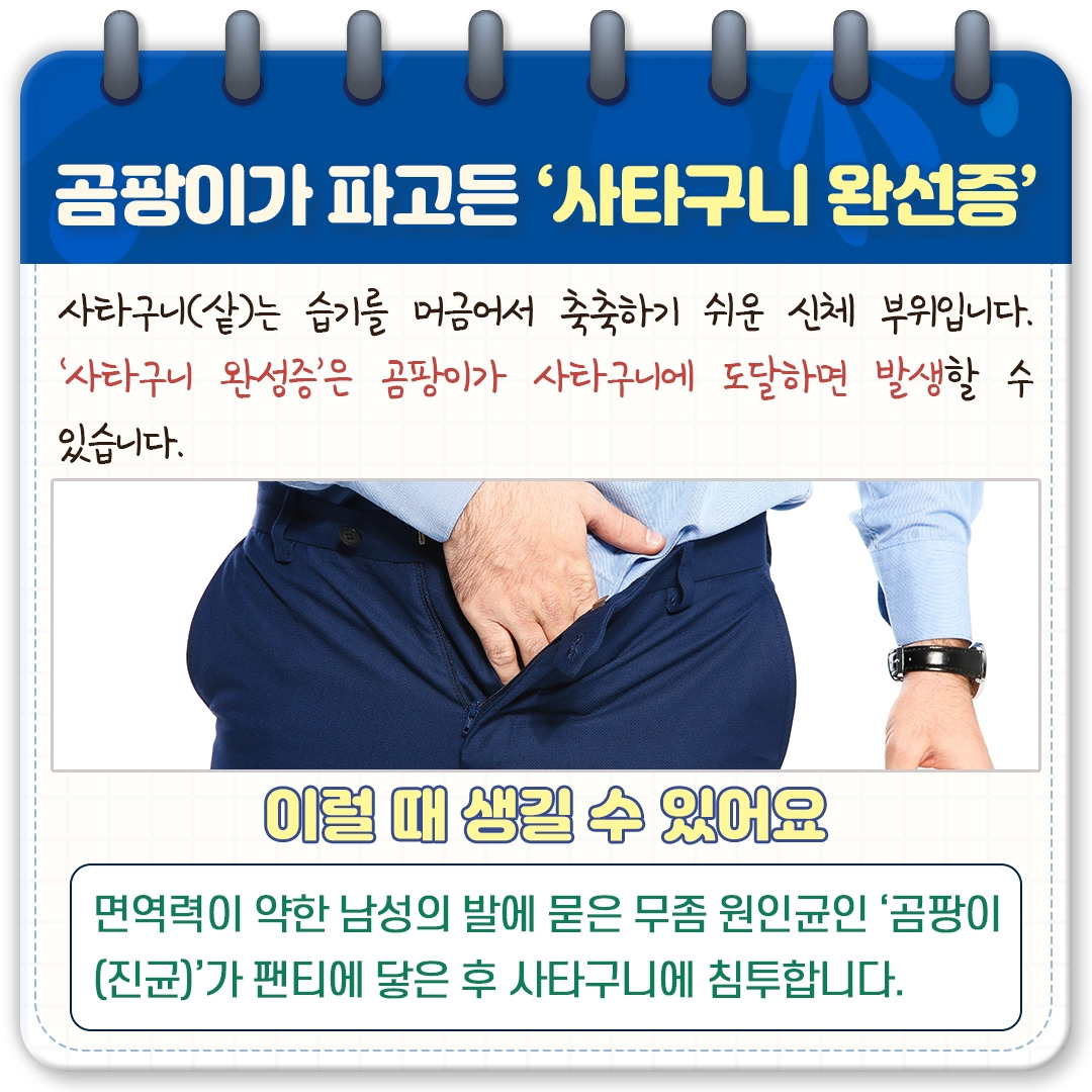 성기 가려움증_04.jpg