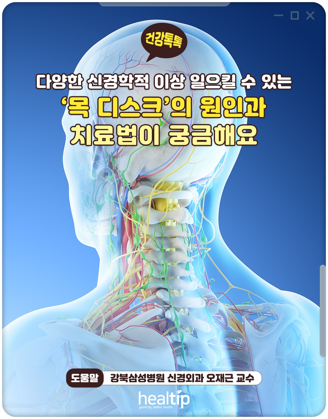 목디스크_00_힐팁.jpg