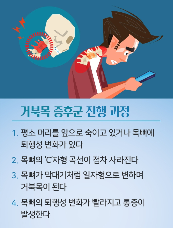 거북목 증후군_5.jpg