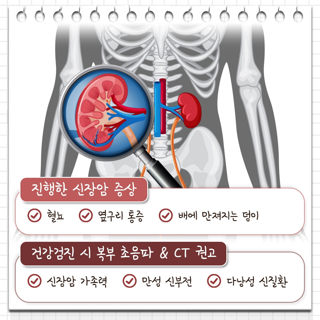신장암_05.jpg
