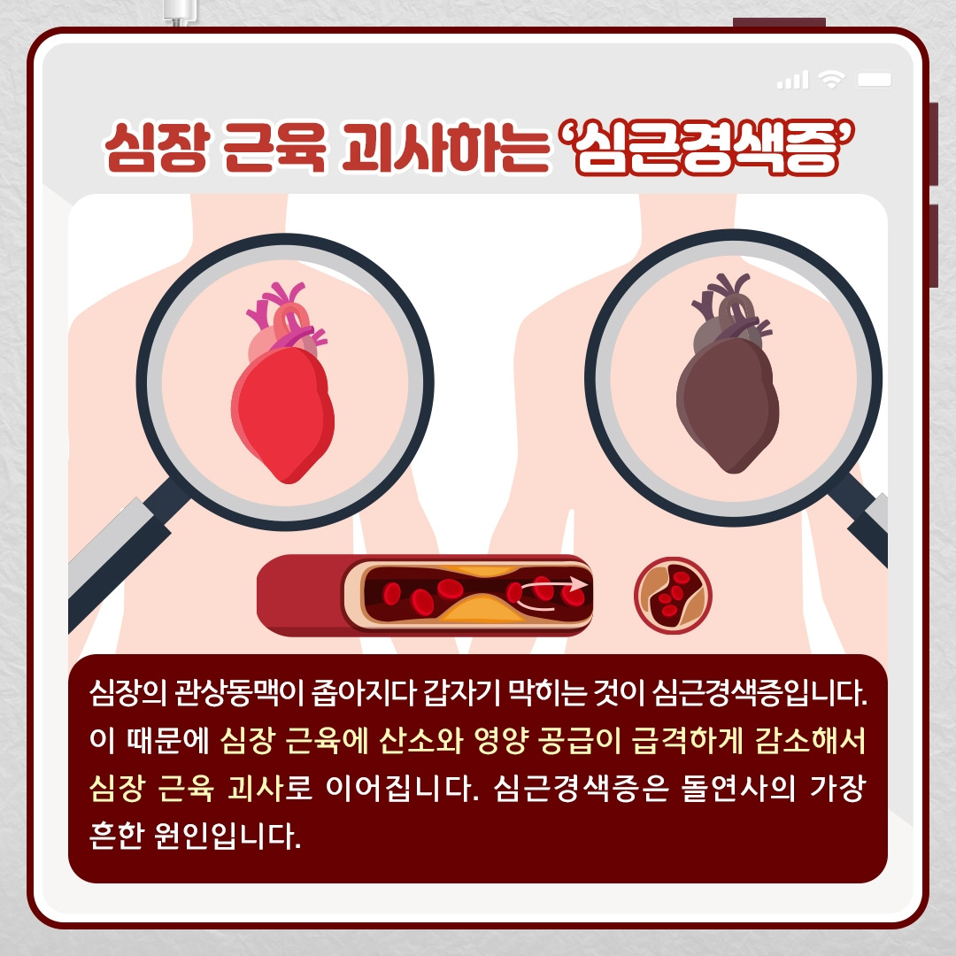 협심증 & 심근경색증_05 .jpg