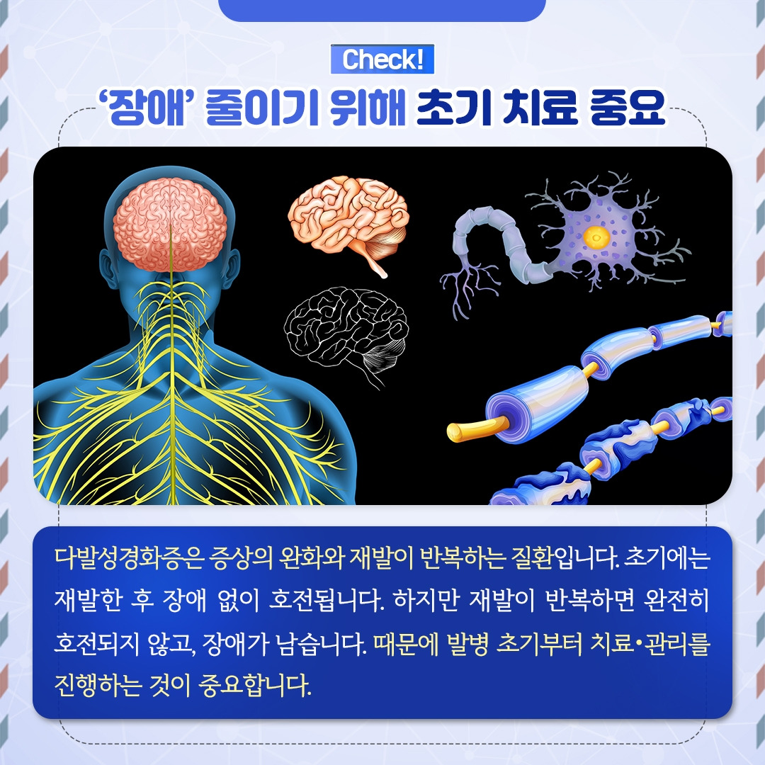 다발성경화증_04.jpg