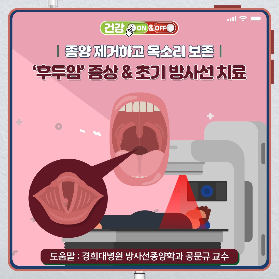후두암_01.jpg