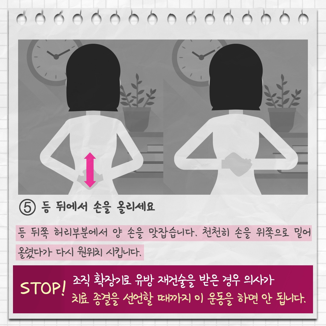 유방재건술 8.jpg