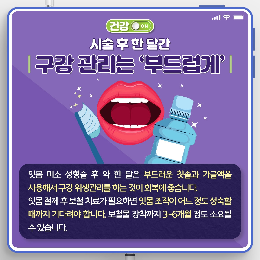 잇몸성형_10.jpg