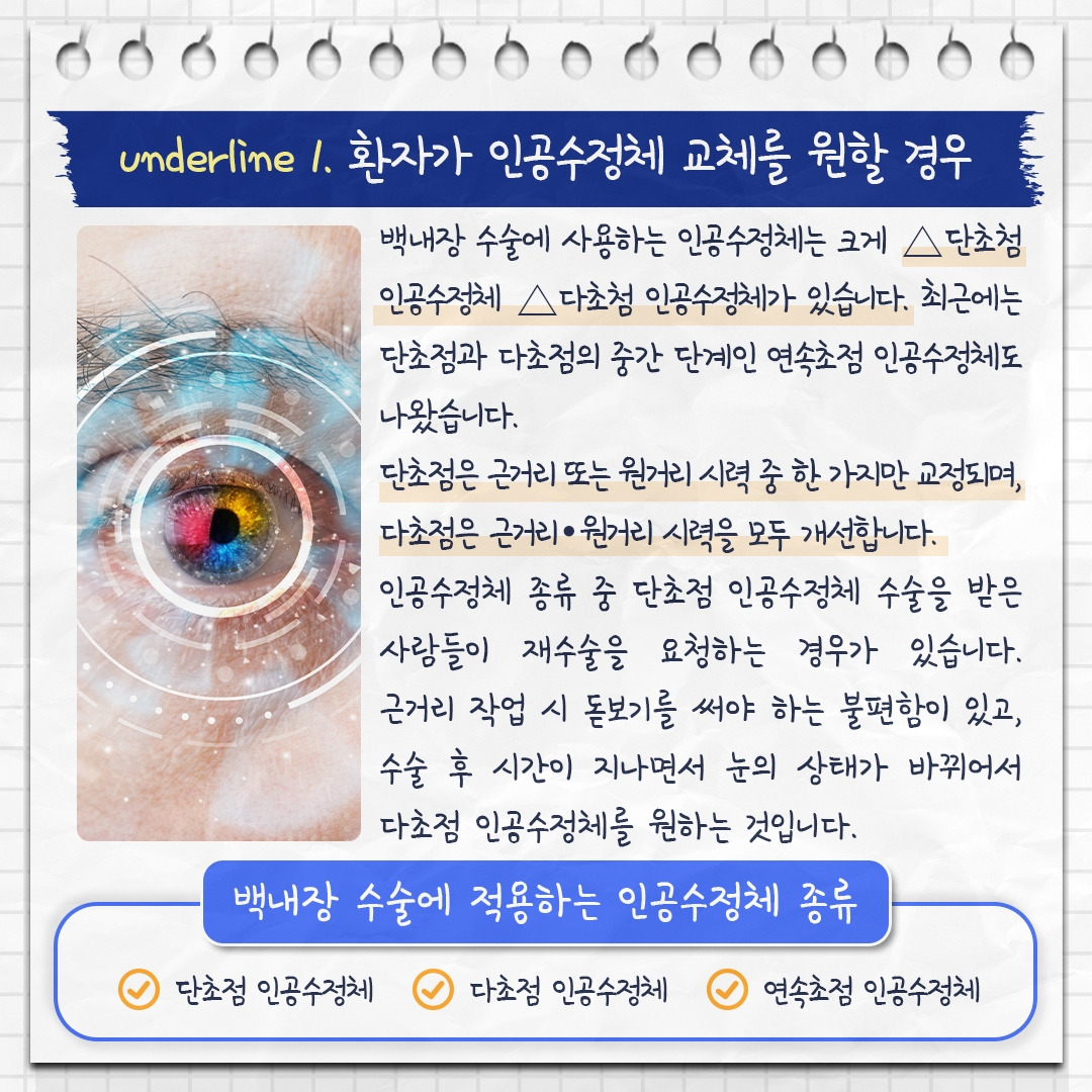 백내장 재수술_05 .jpg