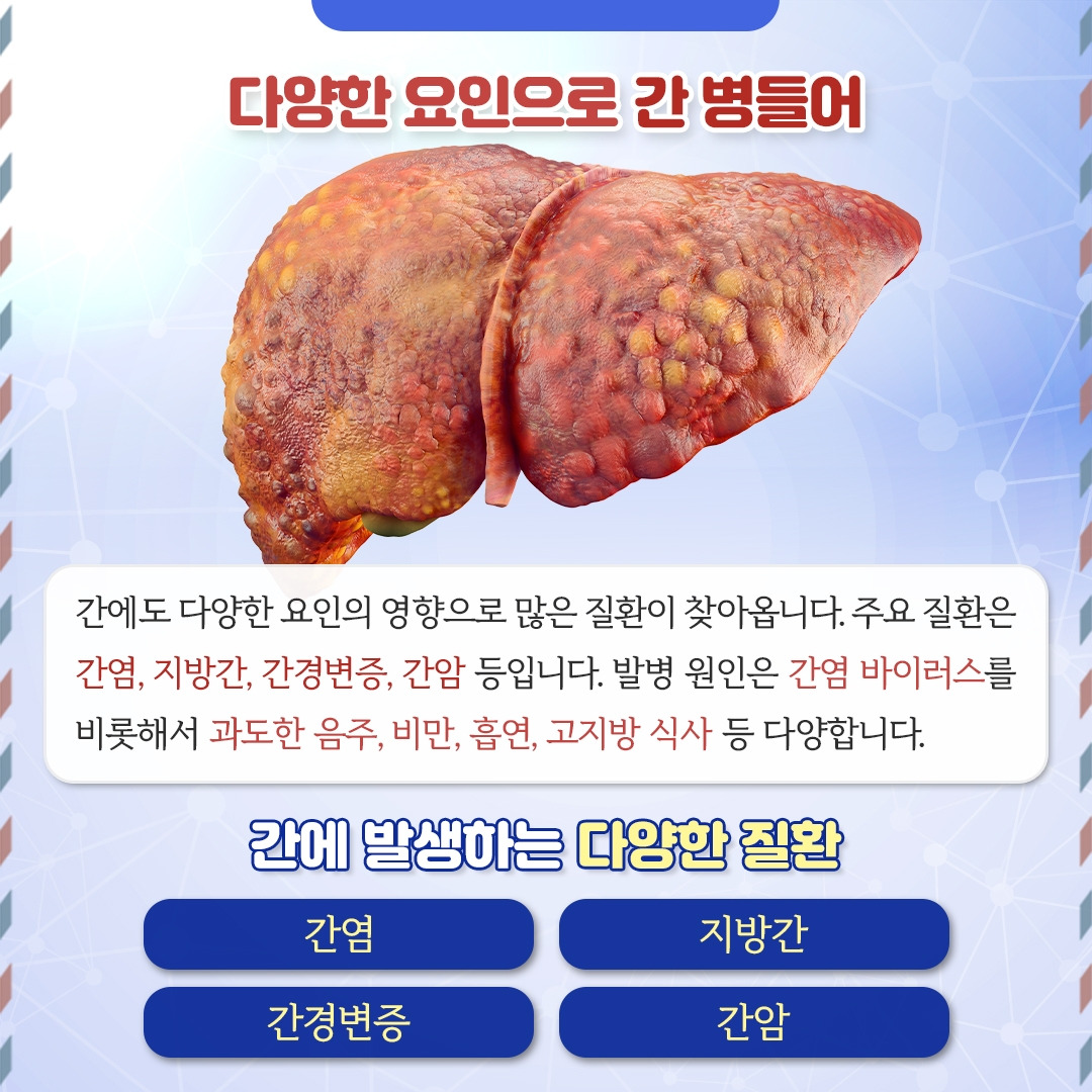 간질환_03.jpg