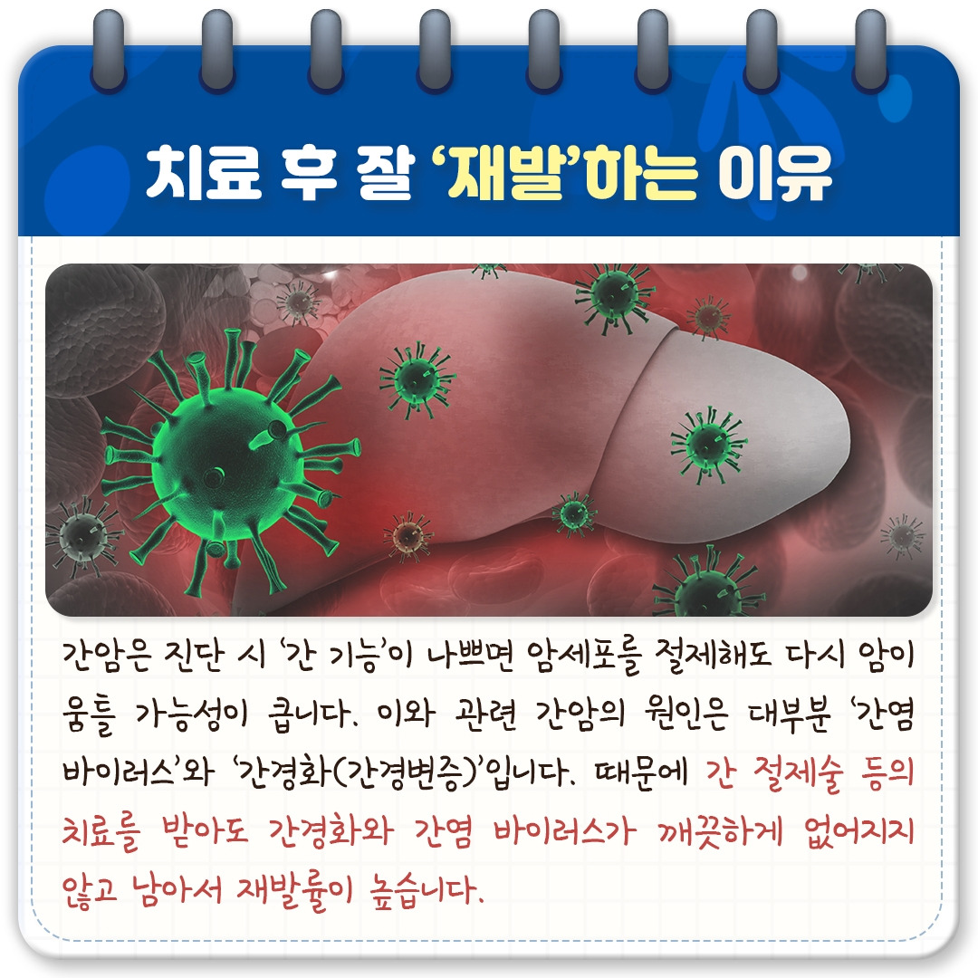 간암 재발_03.jpg