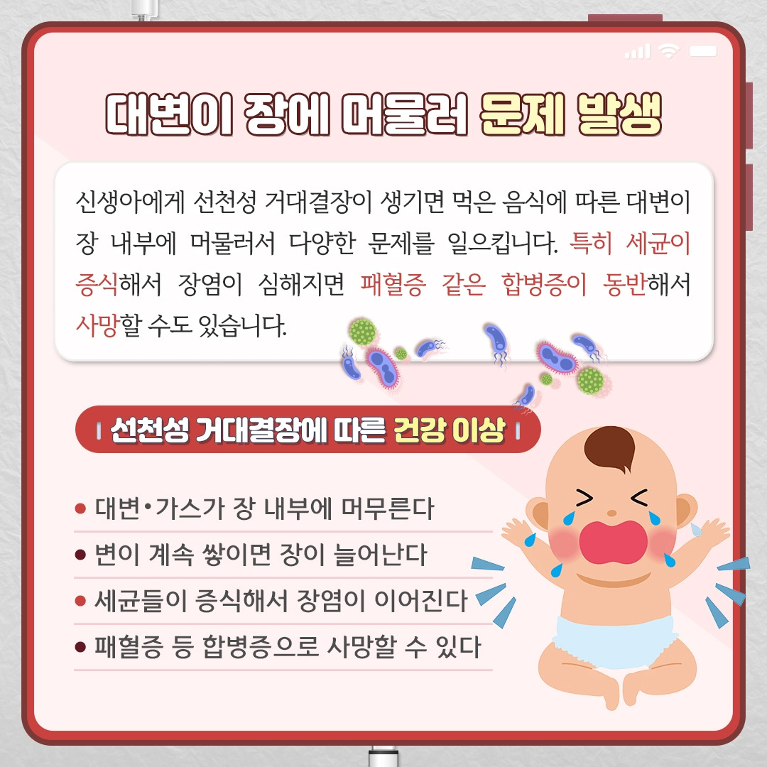 선천성거대결장_03.jpg