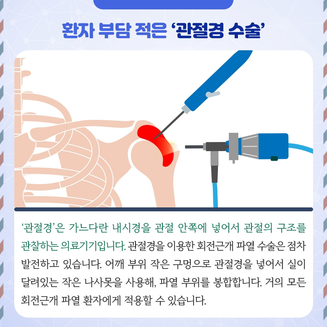 회전근개파열_05.jpg