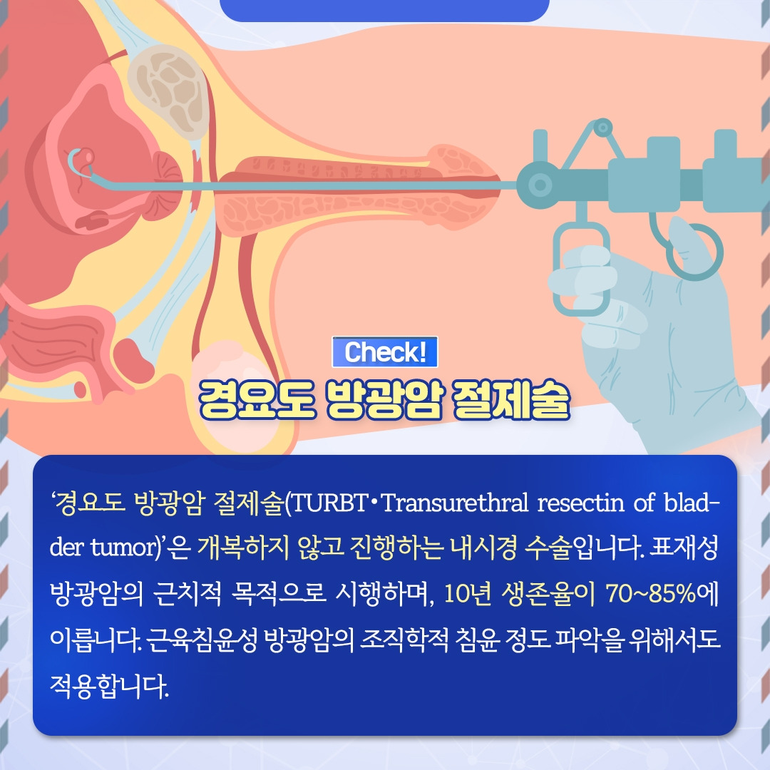 방광암_06.jpg