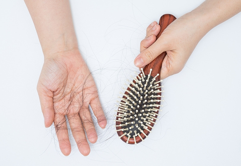 3.※탈모 의심 증상.jpg