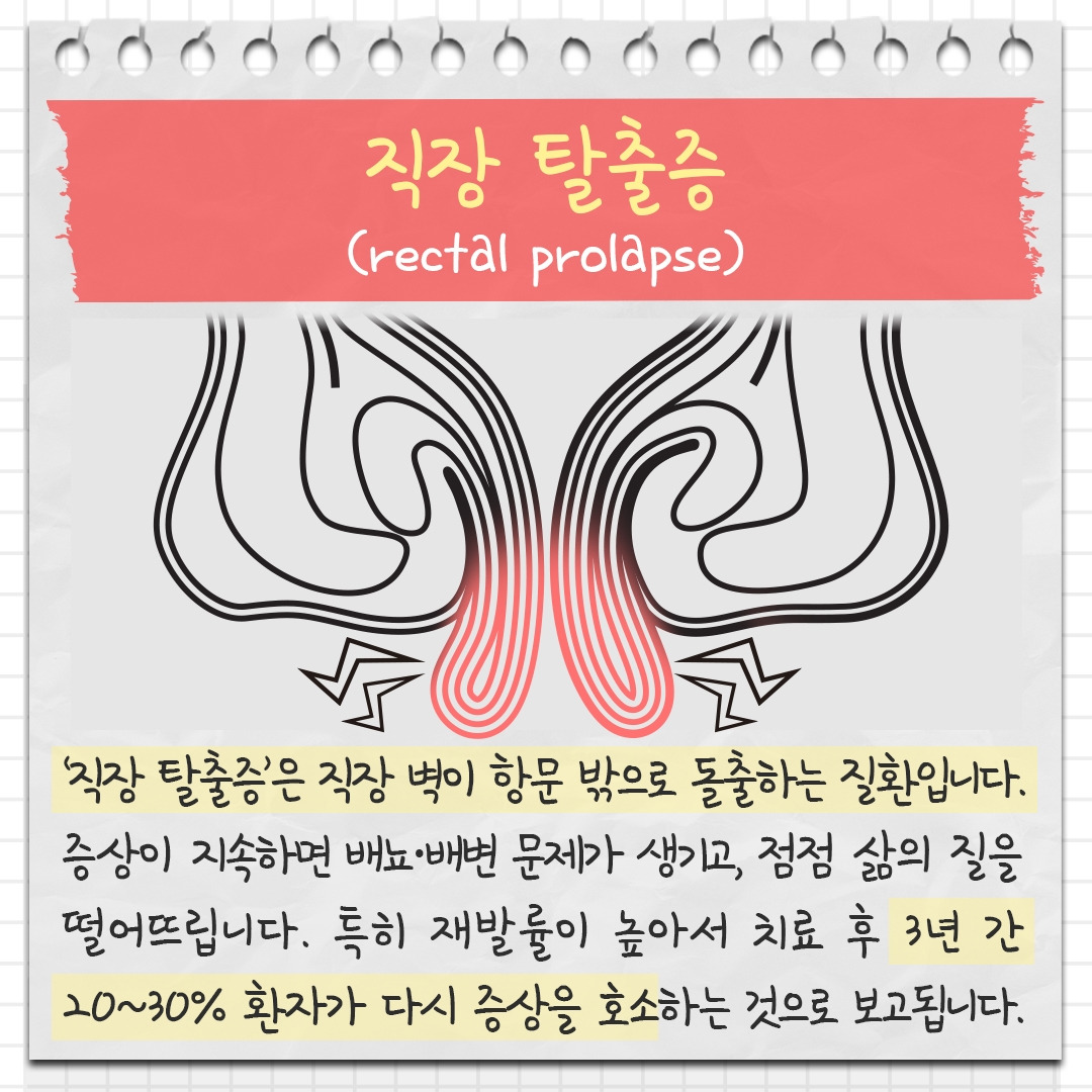 직장 탈출증 1 .jpg