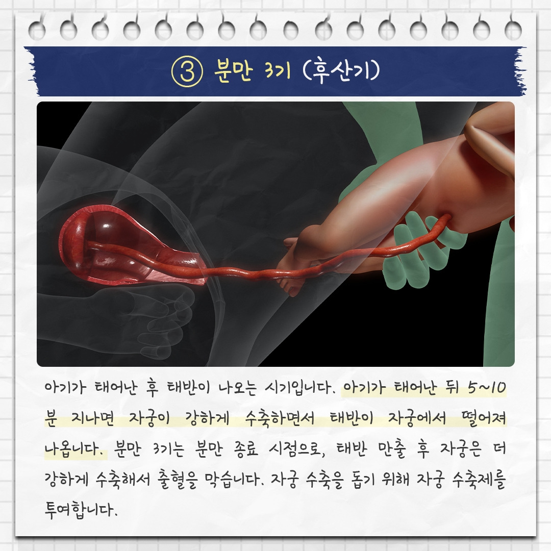 출산 징후_08 .jpg
