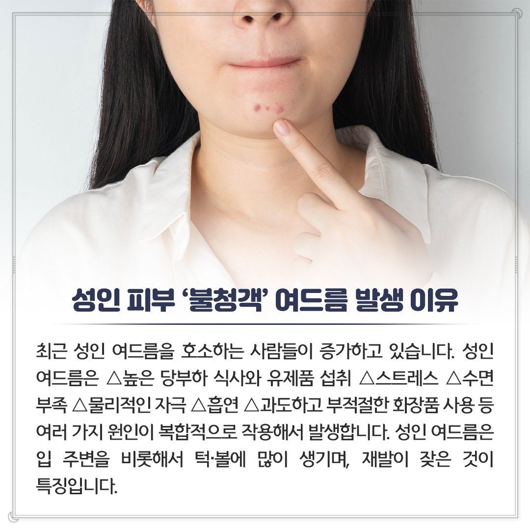 성인여드름_04.jpg