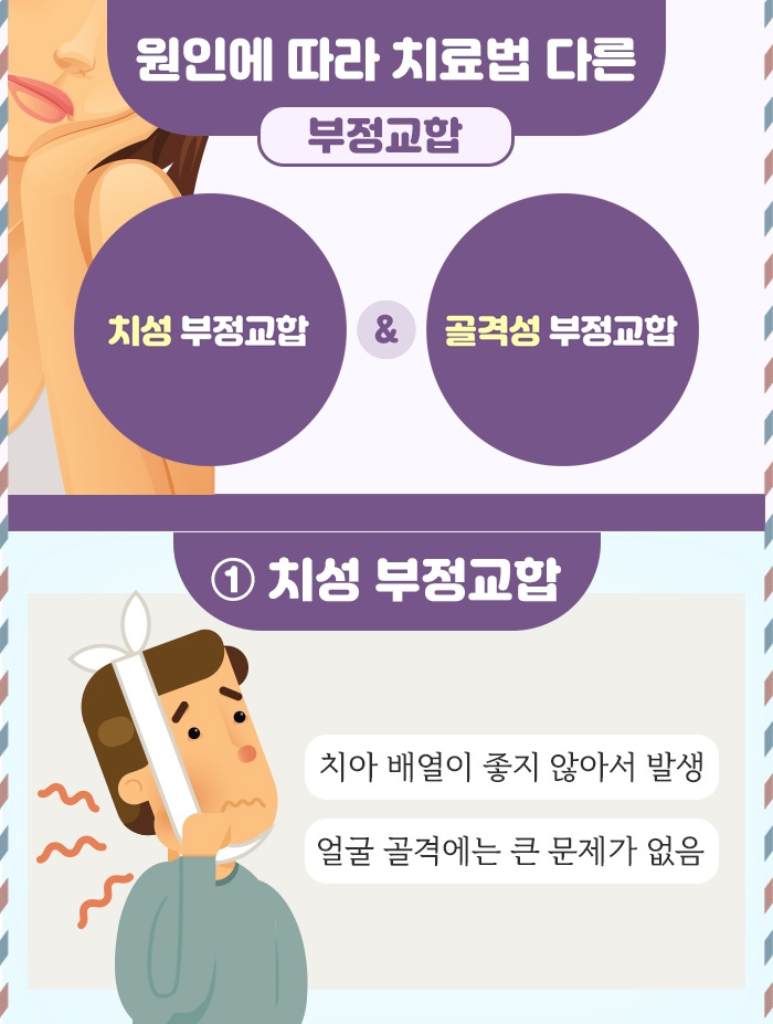 부정교합_3 .jpg