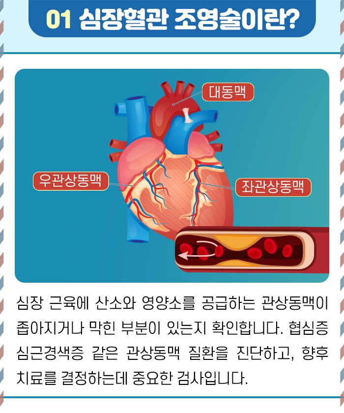 심혈관조영술_02.jpg
