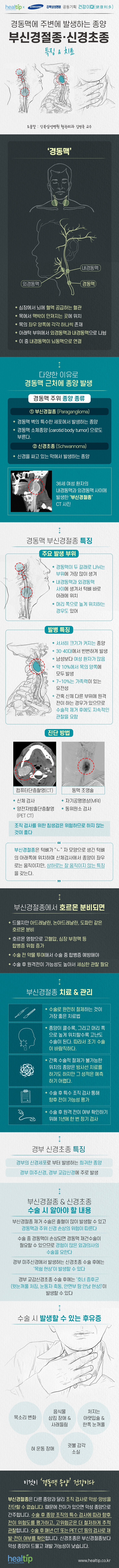 경동맥 종양_힐팁_210402.jpg