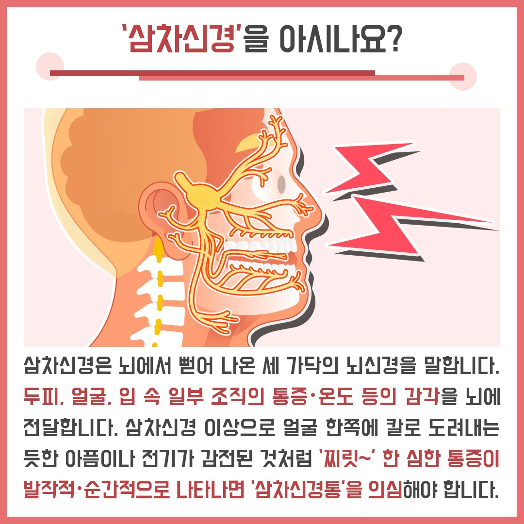 삼차신경통_02 .jpg