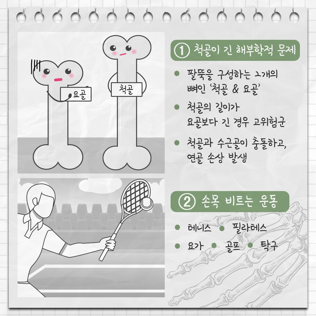 척골충돌증후군 5.jpg