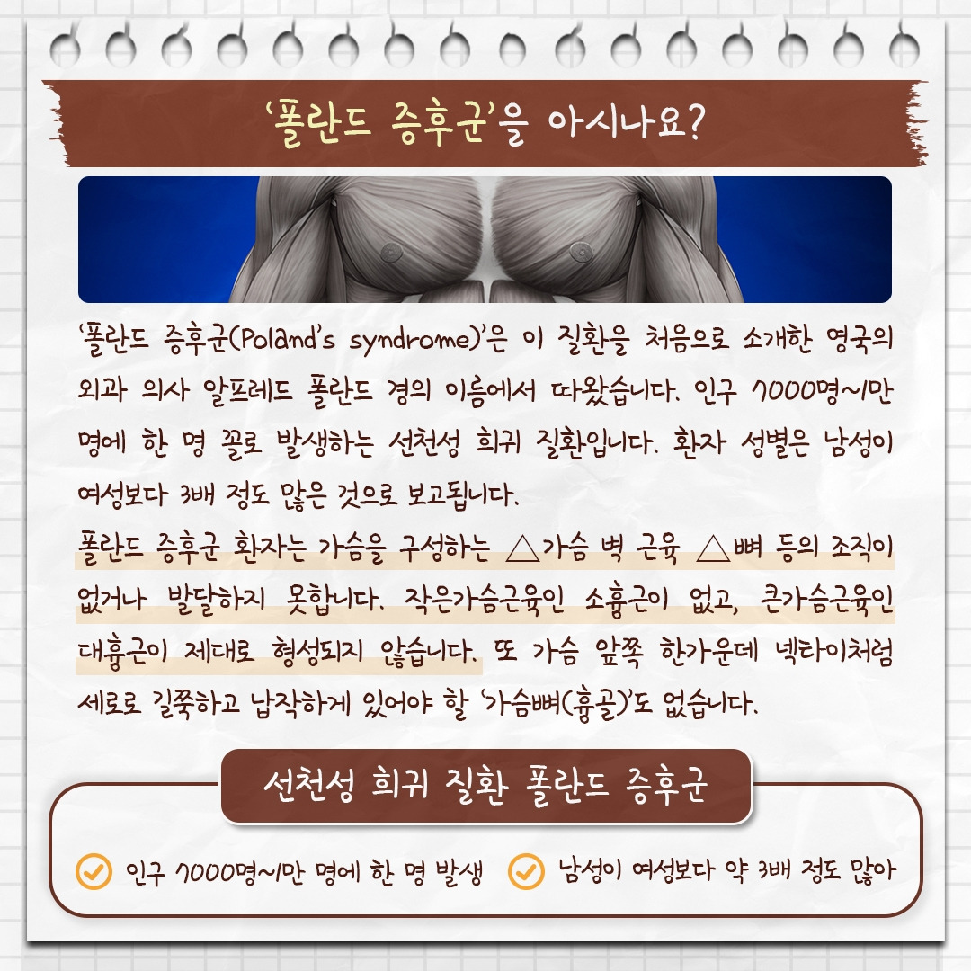 폴란드증후군_02 .jpg