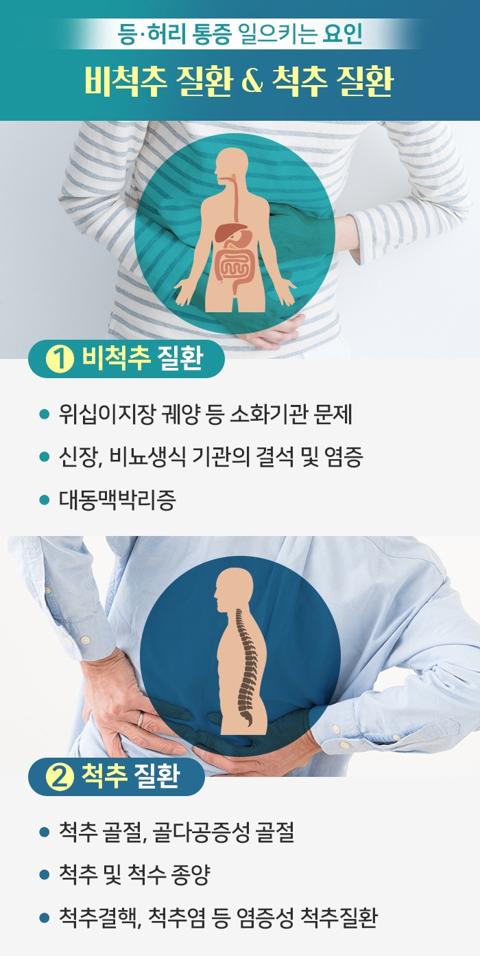 등 통증_4.jpg