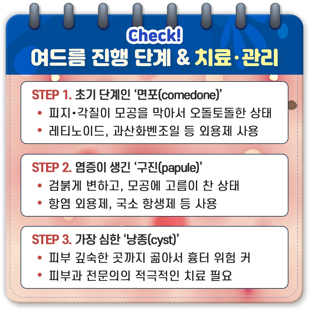 여름철 여드름_04.jpg