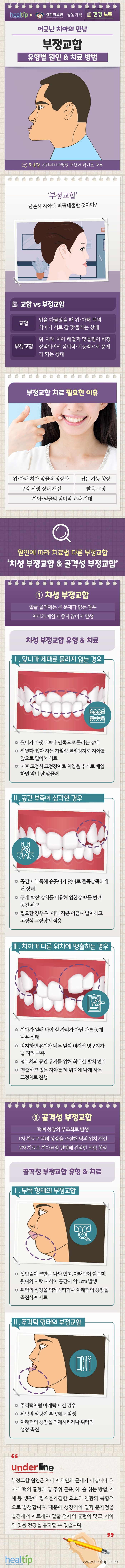 부정교합_힐팁_210805.jpg
