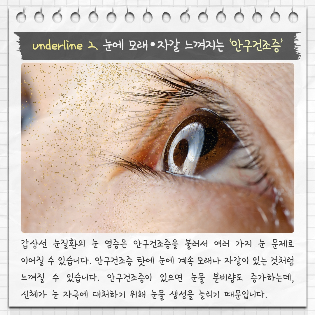 갑상선 눈질환_05 .jpg