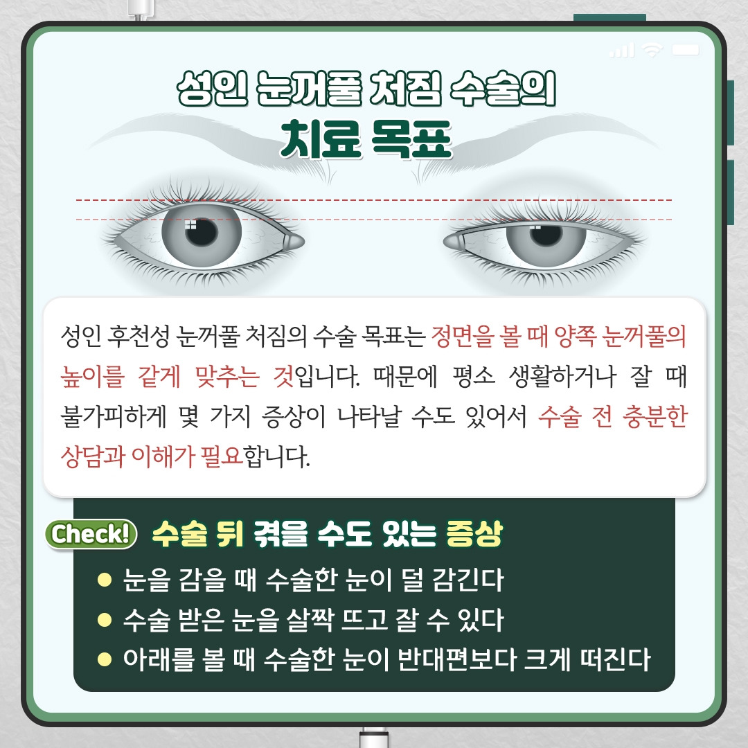 안검하수_07.jpg