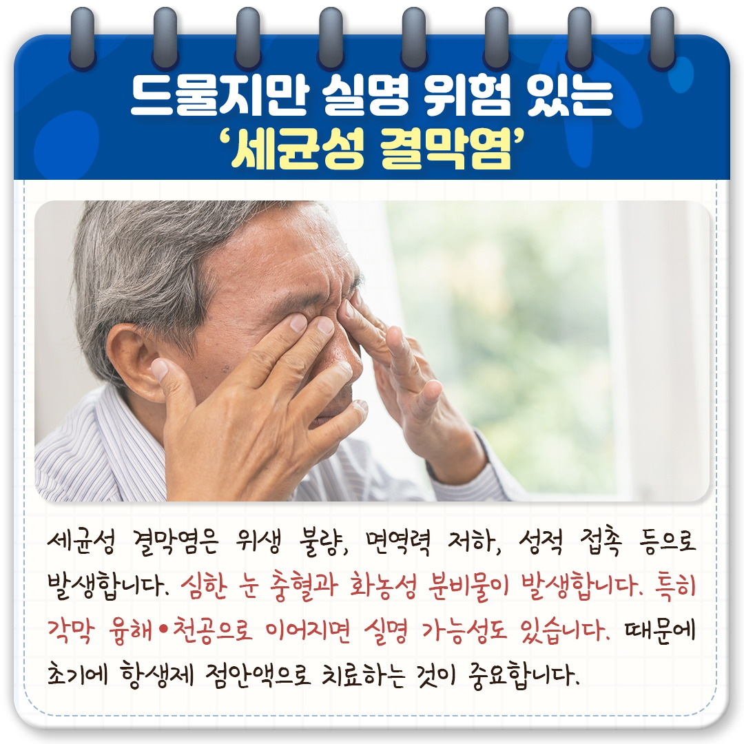 결막염_05.jpg