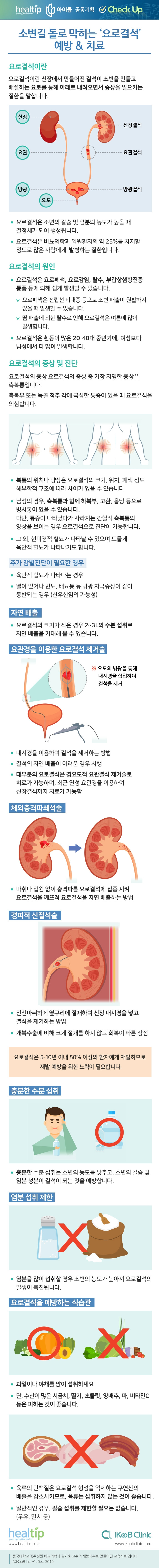체크업38_소변길 돌로 막히는 ‘요로결석’ 예방 & 치료.jpg