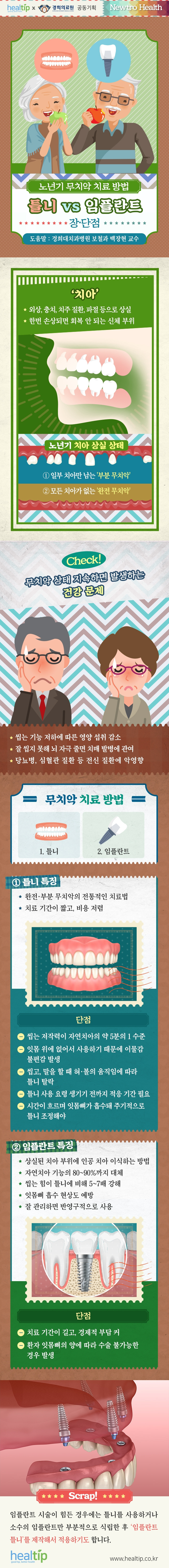 틀니 임플란트_힐팁_220518.jpg